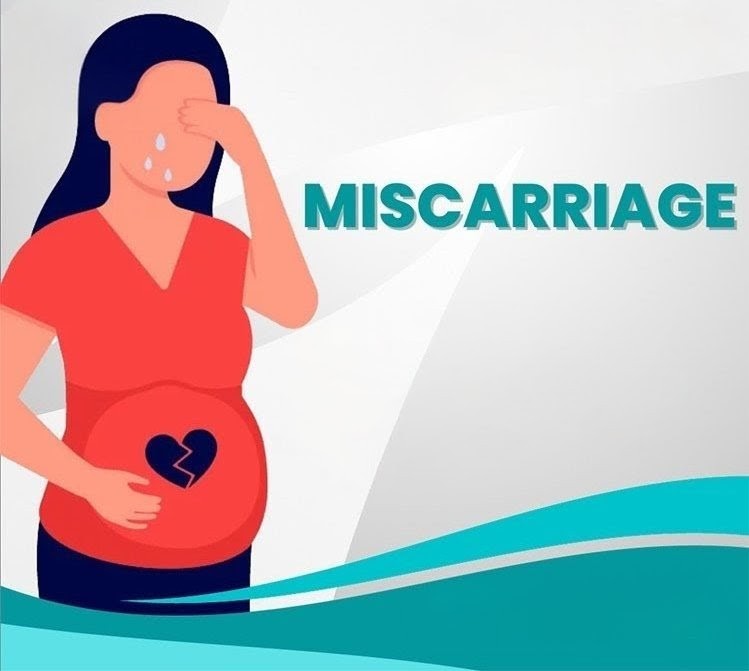 Miscarriage