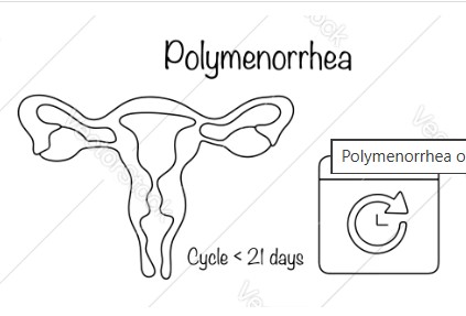 Polymenorrhea